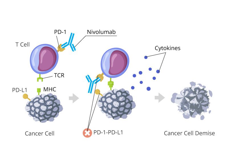 Nivolumab cancer demise